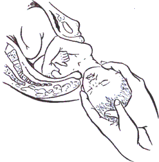 nascita-cervicale